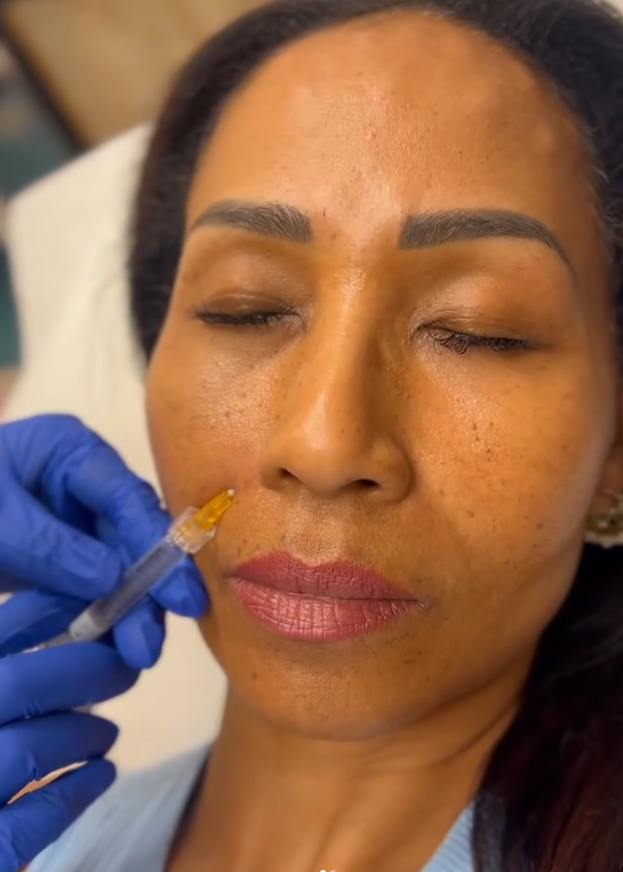 Botox price per area Utah