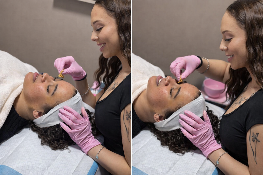 Chemical Peel Treatments Available in Pleasant View, UT