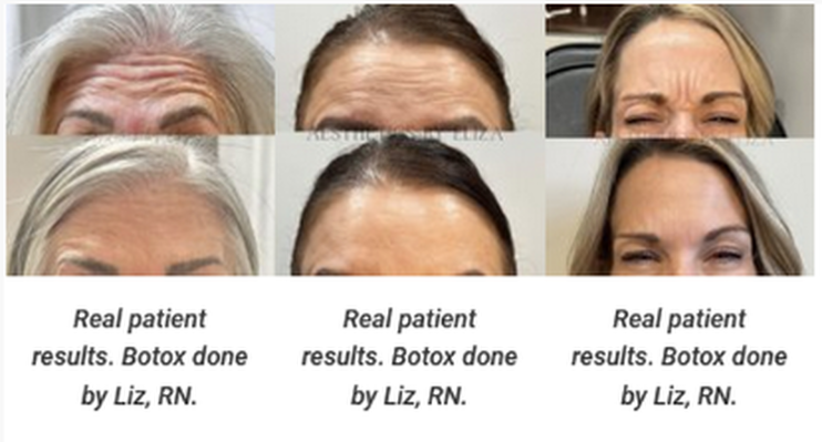 neurotoxin patients