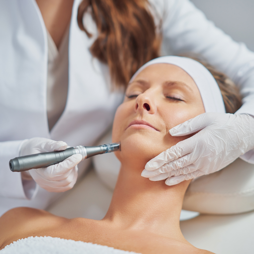 microneedling