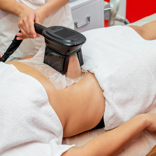 vein removal