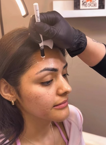 how much is Botox in Pleasant View UT