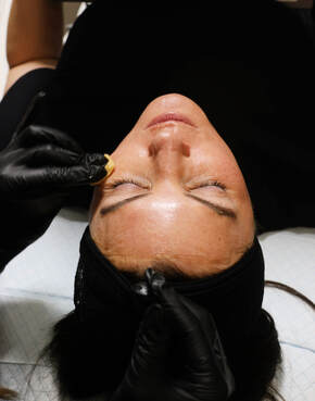 neurotoxin treatment