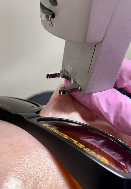 vascular reduction