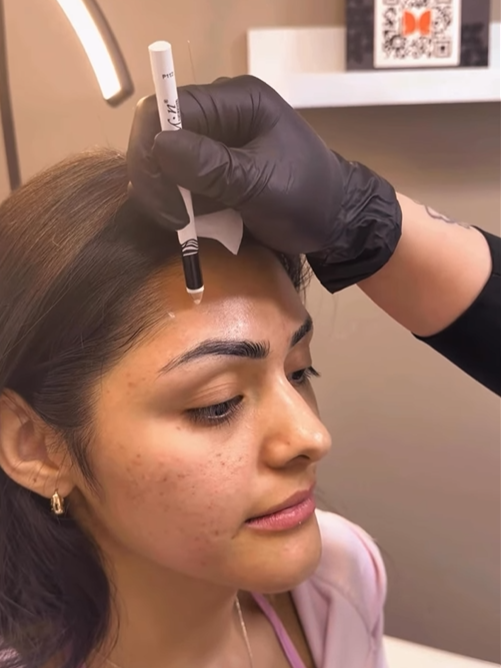 ideal age for Botox treatments North Ogden UT