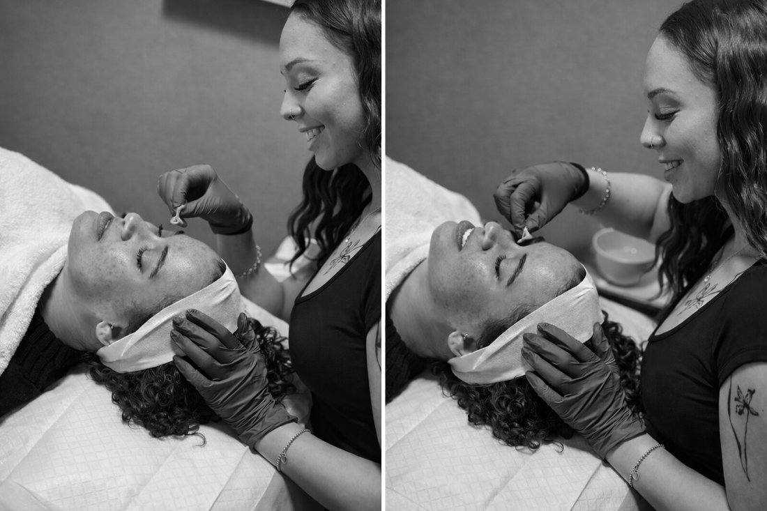 Medical Grade Chemical Peels Near Pleasant View