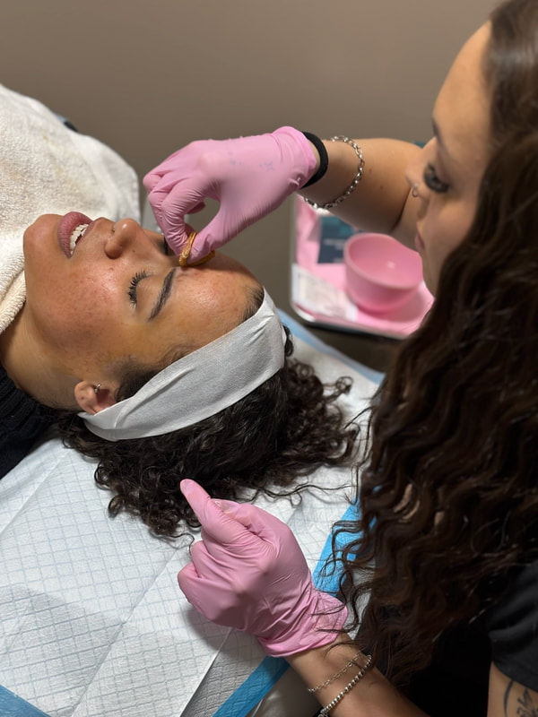 Acne-Fighting Chemical Peels in Pleasant View