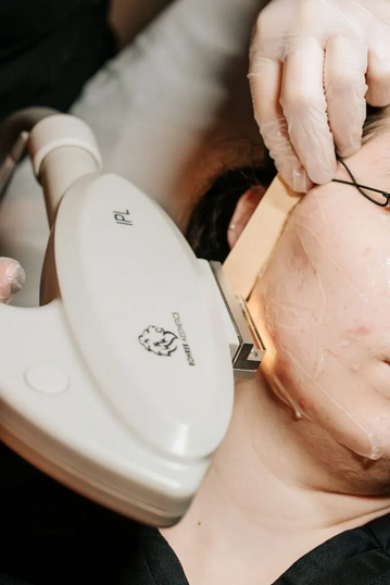 facial hair removal