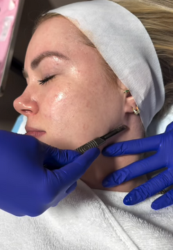 dermaplaning facial Pleasant View Utah