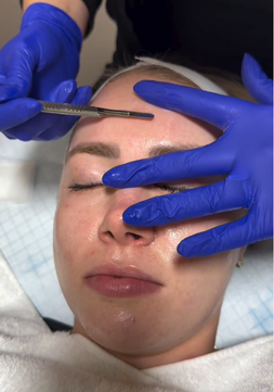 professional dermaplaning near Pleasant View
