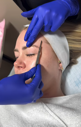exfoliating dermaplaning treatment Pleasant View