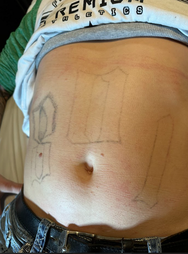 laser tattoo removal Pleasant View UT