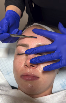 dermaplaning Pleasant View UT
